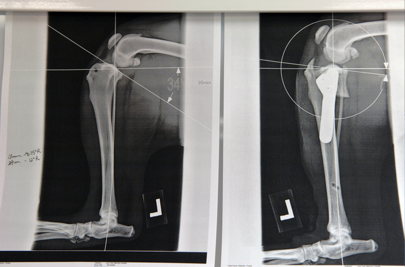 Before and after x-rays Before and after x-rays