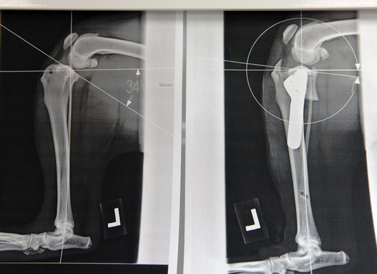 Before and after x-rays